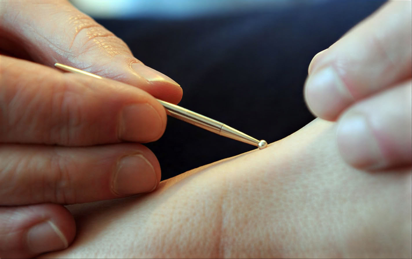 Voedend Leven LA • Acupunctuur & Chinese Geneeskunde